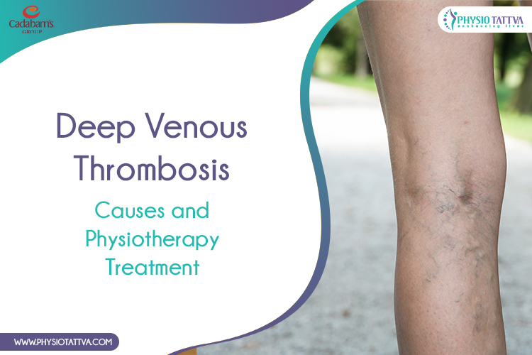 6295fd4754c377686458a71b_Deep-Venous-Thrombosis