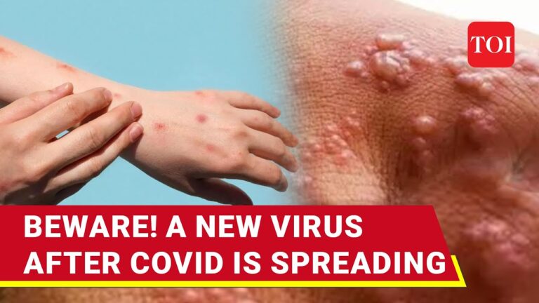 The Emergence of NVC-25: A Comprehensive Overview of the New Virus